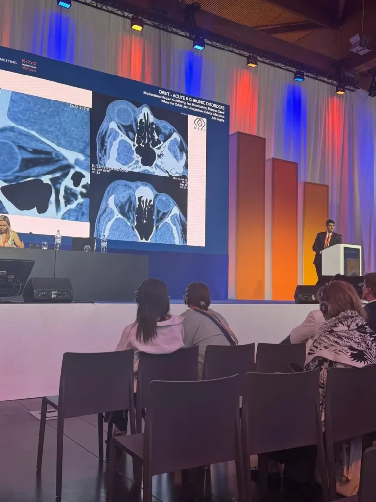 Dr. Adit Gupta presenting his clinical case studies and orbital CT scans on the main stage at ESOPRS 2026.